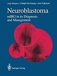 Neuroblastoma: Mibg in Its Diagnosis and Management (Hardcover)