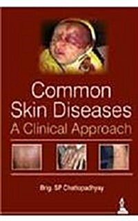 COMMON SKIN DISEASES (Paperback)