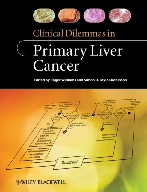 Clinical Dilemmas in Primary Liver Cancer (Other Digital)