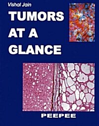 Tumors at a Glance (Paperback)