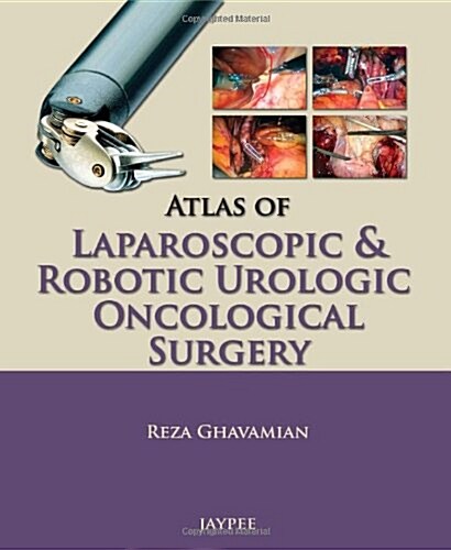 Atlas of Laparoscopic and Robotic Urologic Oncological Surgery (Paperback)