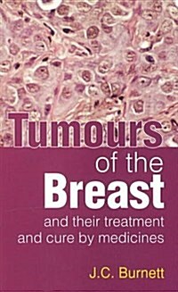 Tumours of the Breast (Paperback, UK)