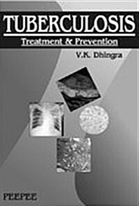 Tuberculosis : Treatment and Prevention (Paperback)