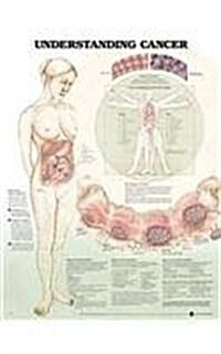Understanding Cancer Anatomical Chart (Chart, Wall)