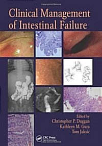 Clinical Management of Intestinal Failure (Hardcover, New)