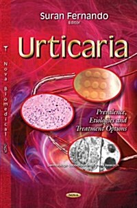 Urticaria (Hardcover, UK)