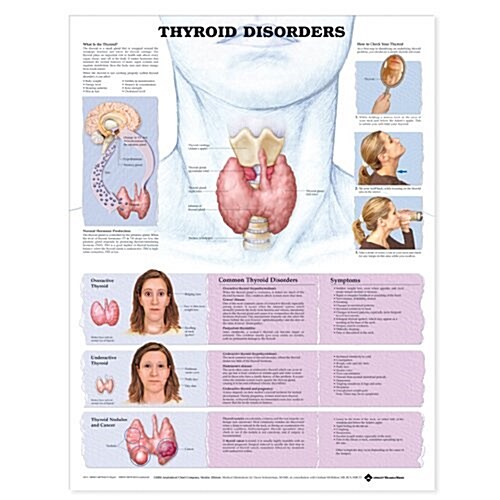 Thyroid Disorders Anatomical Chart (Hardcover)