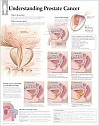 Understanding Prostate Cancer Wall Chart (Other)