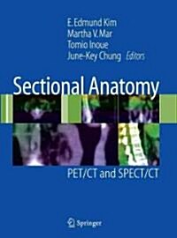 Sectional Anatomy: PET/CT and SPECT/CT (Paperback)