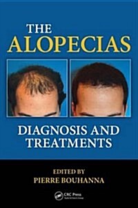 The Alopecias: Diagnosis and Treatments (Hardcover)