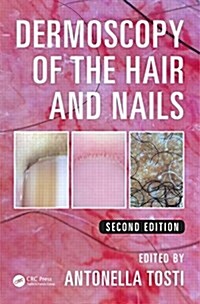 Dermoscopy of the Hair and Nails (Hardcover, 2)