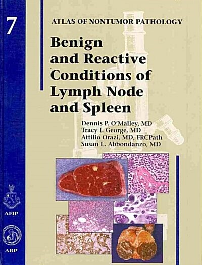 Benign and Reactive Conditions of Lymph Node and Spleen (Hardcover, 1st)