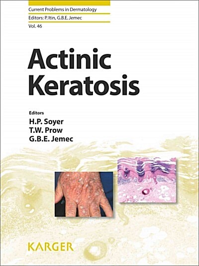 Actinic Keratosis (Hardcover)