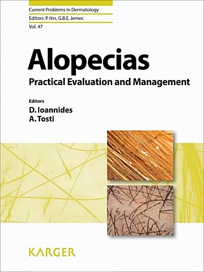 Alopecias (Hardcover)
