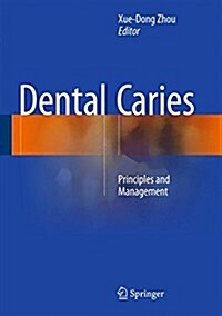 Dental Caries: Principles and Management (Hardcover, 2016)