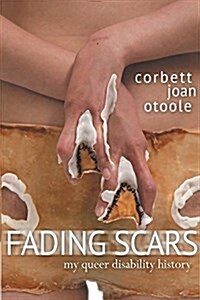 Fading Scars: My Queer Disability History (Paperback)