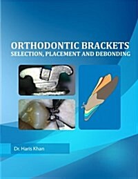 Orthodontic Brackets: Selection, Placement and Debonding (Paperback)