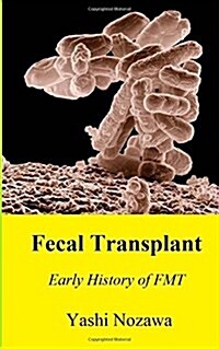 Fecal Transplant: Early History of Fmt (Paperback)