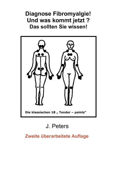 Diagnose Fibromyalgie! Und was kommt jetzt?: Das sollten sie Wissen! (Paperback)