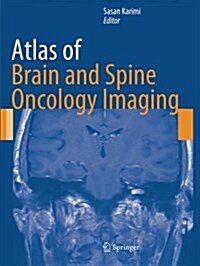 Atlas of Brain and Spine Oncology Imaging (Paperback)