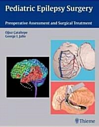 Pediatric Epilepsy Surgery: Preoperative Assessment and Surgical Treatment (Hardcover)