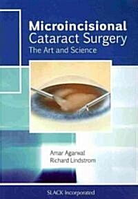 Microincisional Cataract Surgery: The Art and Science (Paperback)