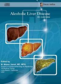 Alcoholic liver disease : [electronic resource] : an overview