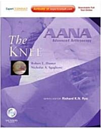 AANA Advanced Arthroscopy: The Knee : Expert Consult: Online, Print and DVD (Hardcover)