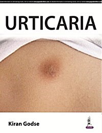 URTICARIA (Paperback)