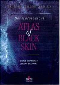 Dermatological Atlas of Black Skin (Skin of Color Series) (Skin of Colour) (Hardcover, 1)