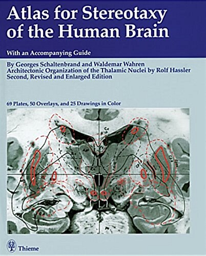 Atlas for Stereotaxy of the Human Brain (Hardcover, 2)