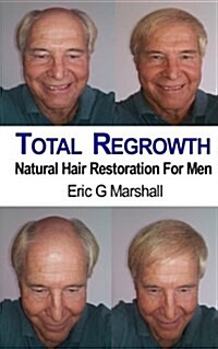 Total Regrowth: Natural Hair Restoration for Men (Paperback)