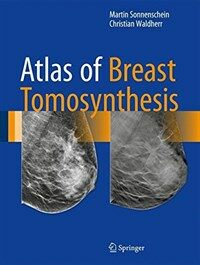 Atlas of breast tomosynthesis [electronic resource] : imaging findings and image-guided interventions