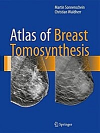 Atlas of Breast Tomosynthesis: Imaging Findings and Image-Guided Interventions (Hardcover, 2017)