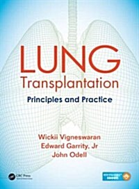 Lung Transplantation: Principles and Practice (Hardcover)