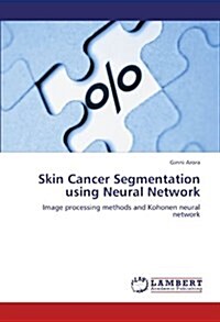 Skin Cancer Segmentation Using Neural Network (Paperback)