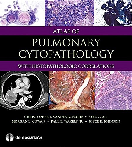 Atlas of Pulmonary Cytopathology (Hardcover)