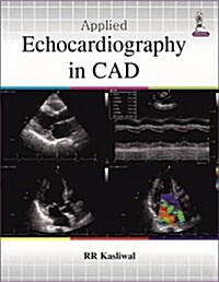 Applied Echocardiography in Coronary Artery Disease (Hardcover)