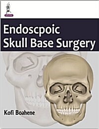 Minimal Access Skull Base Surgery: Open and Endoscopic Assisted Approaches (Hardcover)
