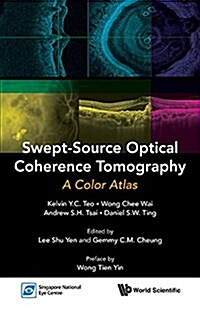 Swept-Source Optical Coherence Tomography: A Color Atlas (Paperback)