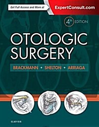 Otologic Surgery (Hardcover, 4)
