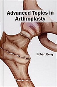 Advanced Topics in Arthroplasty (Hardcover)