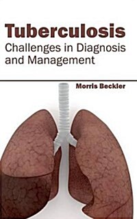 Tuberculosis: Challenges in Diagnosis and Management (Hardcover)