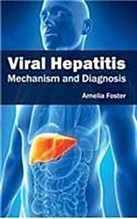 Viral Hepatitis: Mechanism and Diagnosis (Hardcover)