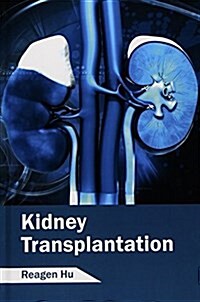 Kidney Transplantation (Hardcover)