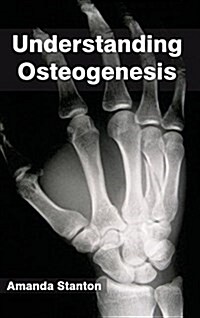 Understanding Osteogenesis (Hardcover)