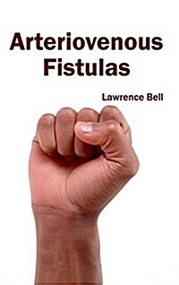 Arteriovenous Fistulas (Hardcover)