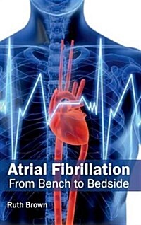 Atrial Fibrillation: From Bench to Bedside (Hardcover)