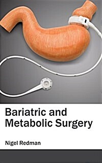 Bariatric and Metabolic Surgery (Hardcover)