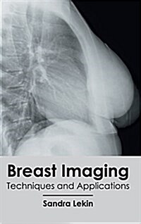 Breast Imaging: Techniques and Applications (Hardcover)